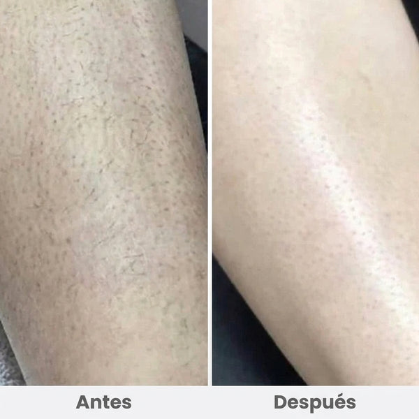 Clientes reales, resultados reales